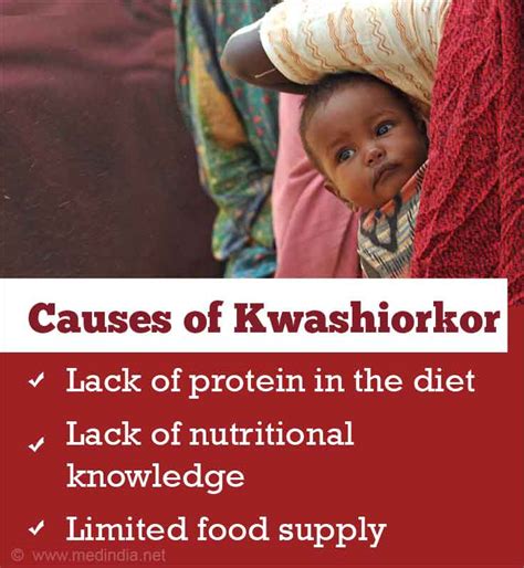 Kwashiorkor Causes