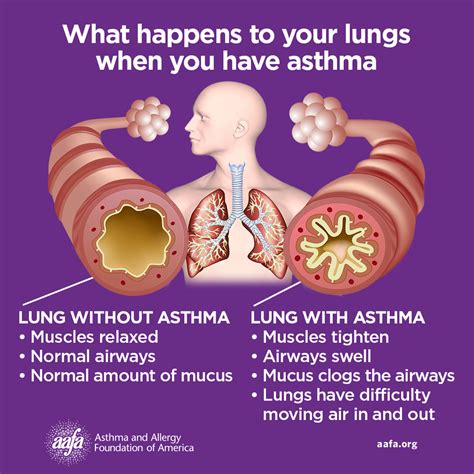 Can I Have A Dog If I Have Asthma