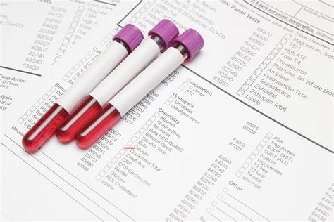 10 most important blood tests comprehensive list – Artofit