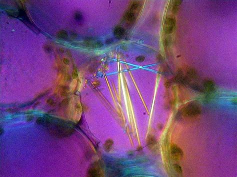 Raphides (calcium oxylate crystals) in a mesophyll cell of the leaf of spider plant ...