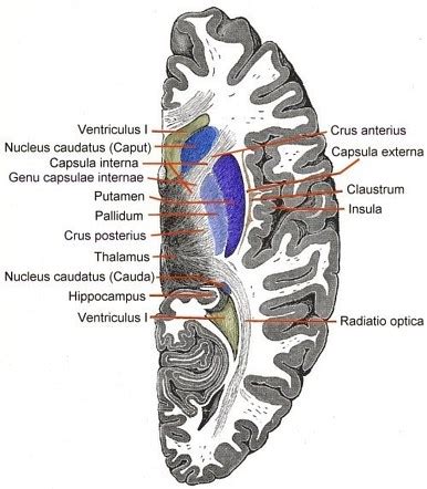 Internal capsule | Radiology Reference Article | Radiopaedia.org