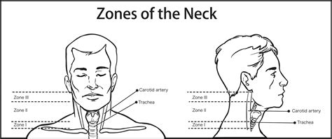 An Anatomical Review of Trauma to the Mouth and Throat… | Relias Media