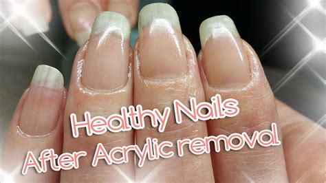 Acrylic Nail Removal | For Healthy Nails - YouTube