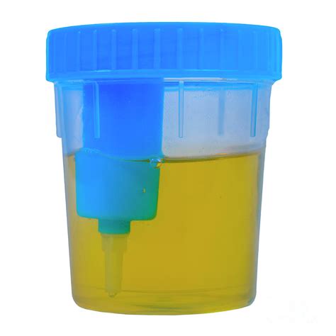 sterile Urine sample in cup j3 Photograph by Ilan Rosen - Fine Art America