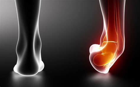 When to Ice or Heat a Foot or Ankle Injury | JAWS Podiatry