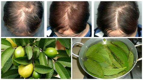 Guava Leaves stop Hair Fall, Health Benefits - Ayurveda