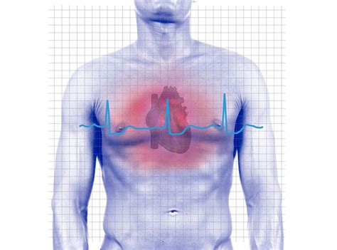 Heart Attack Symptoms in Men: 5 Common Signs - University Health News