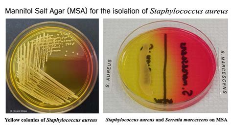 Mannitol Salt Agar for the isolation of Staphylococcus aureus