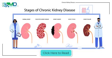 Chronic Kidney Disease System Disorder Template