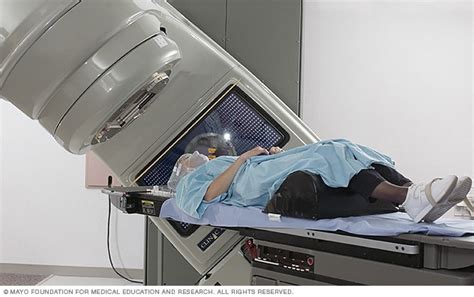 External beam radiation therapy - Mayo Clinic