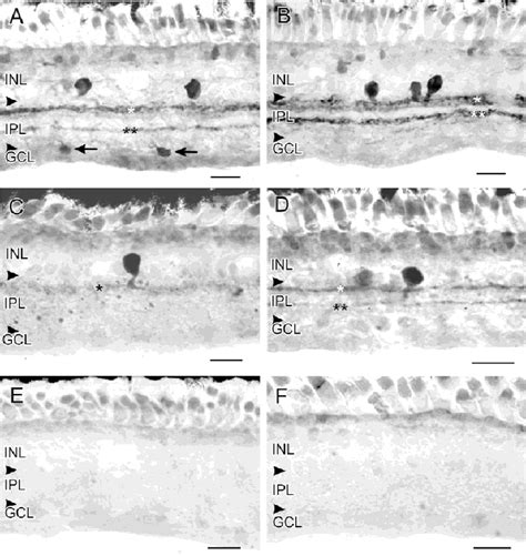 (A) There were clear regional differences in the effects of bicuculline ...