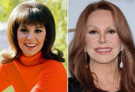 Marlo Thomas Before And After Nose Job