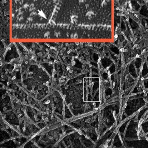 Electron micrograph showing actin filaments and bundles in the... | Download Scientific Diagram