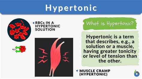 Hypertonic - Definition and Examples - Biology Online Dictionary