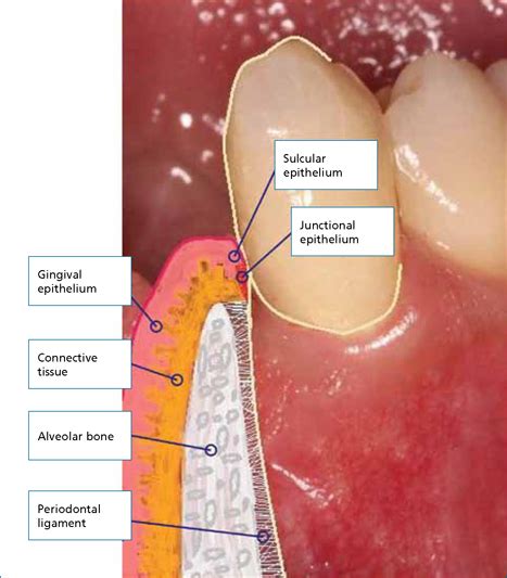 An introduction to periodontal regeneration - DentalNursing