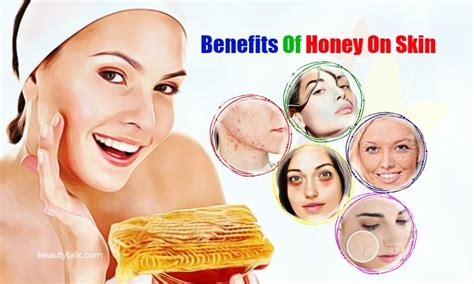 24 Uses & Benefits Of Honey On Skin Issues: Acne & Wrinkles