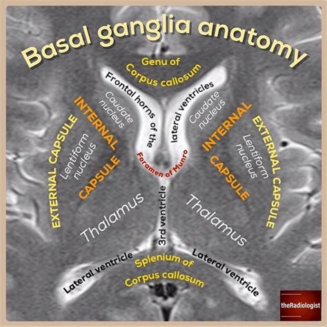 Brain Anatomy, Human Anatomy And Physiology, Medical Anatomy, Radiology Student, Radiology ...