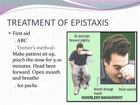 Epistaxis