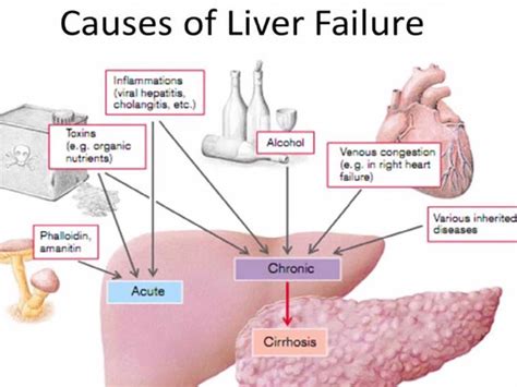 Lab-grown liver raises hopes for ALF patients