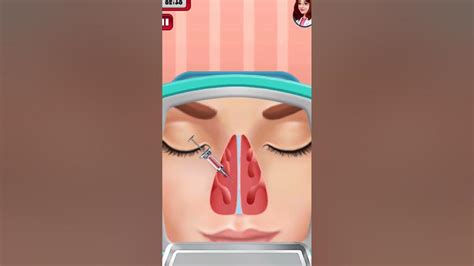 nose surgery for nasal septal hematoma#animation #youtubeshorts - YouTube