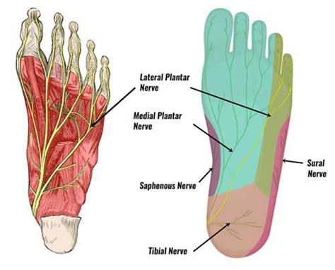 Lateral Plantar Nerve Entrapment - Symptoms, Causes & Treatment
