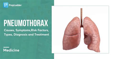 Pneumothorax: Causes, Symptoms, Risk Factors, Types, Diagnosis and Treatment