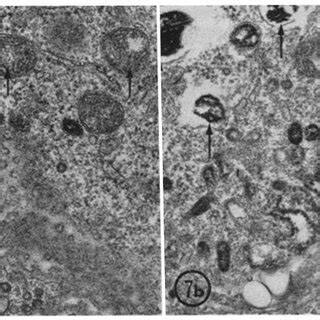 Illustration of the absence of tyrosinase activity in the fenestrated... | Download Scientific ...