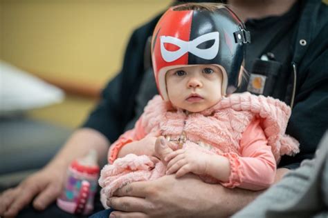 Treating flat head syndrome with a helmet - Hamilton Health Sciences