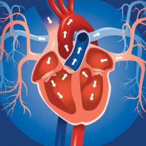 Enlarged heart update: Mild cardiomegaly, left & right atrial enlargement, left & right ...