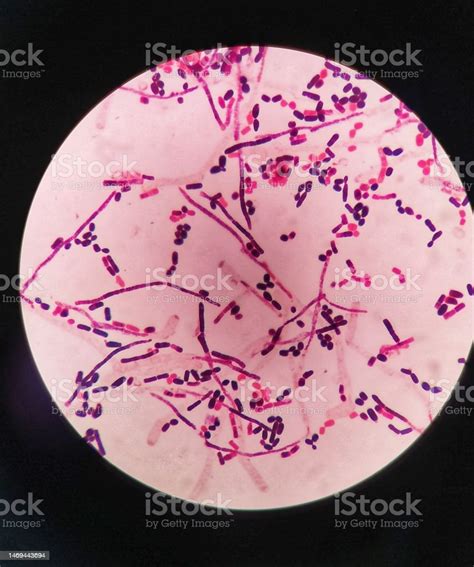 Yeast Cells And Hyphae In Gram Stain Fine With Microscope Stock Photo ...