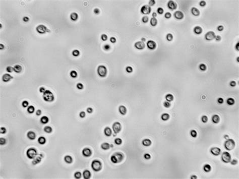 Kluyveromyces thermotolerans | Viticulture and Enology