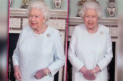 Queen Elizabeth Shows Off Bruised, Purple Hand In Scary New Photos