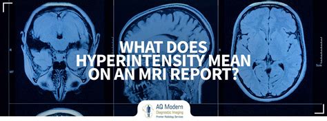 What does MRI hyperintensity mean on an MRI Report?