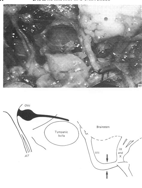 Figure 3 from The otic ganglion and its neural connections in the rat ...