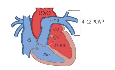 Cardiology 3 Flashcards | Quizlet