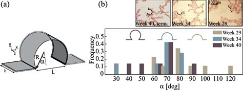 Figure 1 from Biomimetics of fetal alveolar flow phenomena using microfluidics. | Semantic Scholar