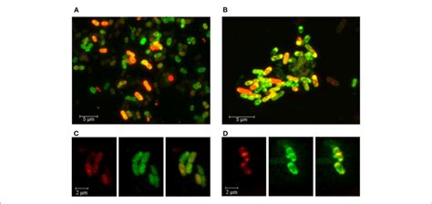 | Fluorescence confocal microscopy imaging of E. coli cells grown in ...