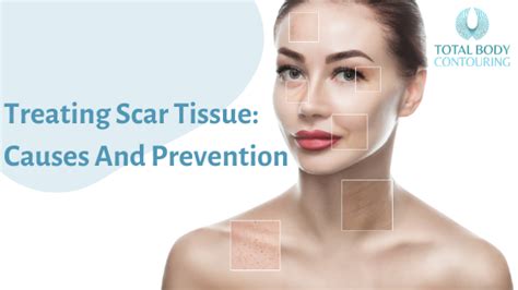 Treating Scar Tissue: Causes And Prevention | Cryotherapy Canberra