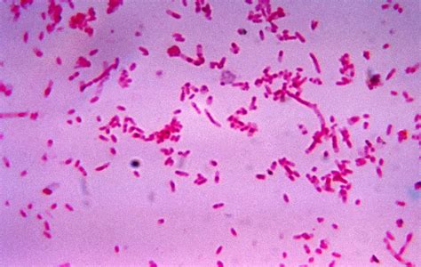 Gram Negative Bacilli (Rods) - Microbiology learning: The "why"ology of ...