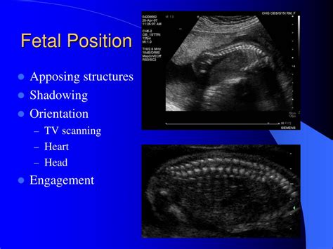 PPT - Obstetric Ultrasound PowerPoint Presentation, free download - ID:4977669