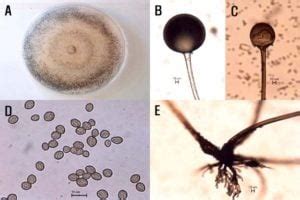 Rhizopus spp- An Overview