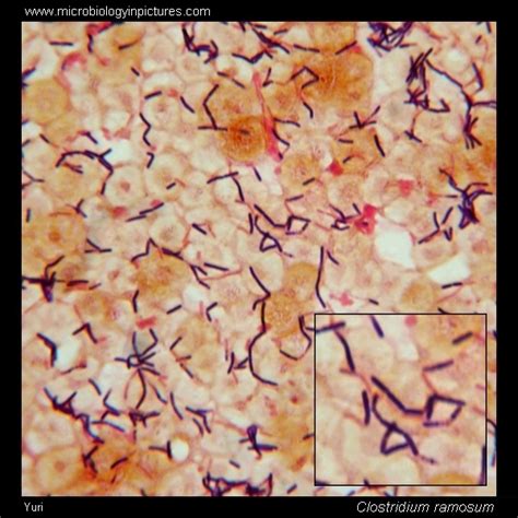 Clostridium Septicum Gram Stain