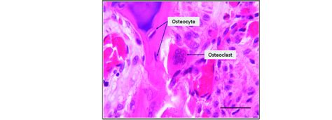 Osteoclasts Histology