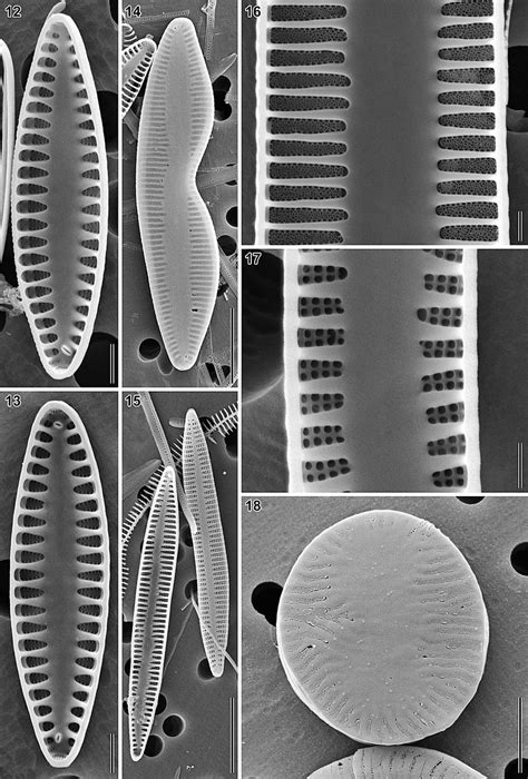 SEM micrographs of representative clones of Tabularia fasciculata ...