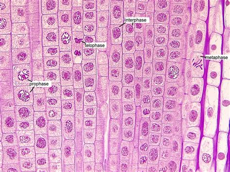 Onion Root Cell Mitosis Labeled - Juventu dugtleon