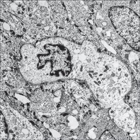 Langerhans cells - بحث Google‏ | Langerhans cell, Cell, Photo