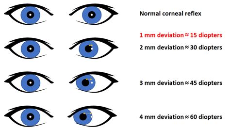 Moran CORE | Alignment Assessment (Hirschberg)