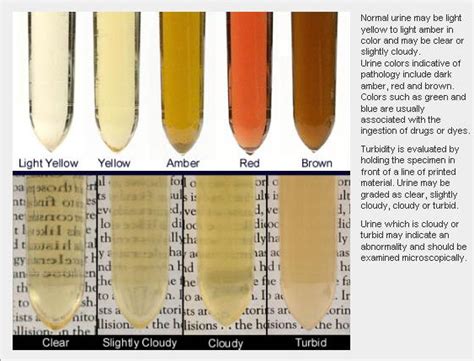 brown urine with sediment