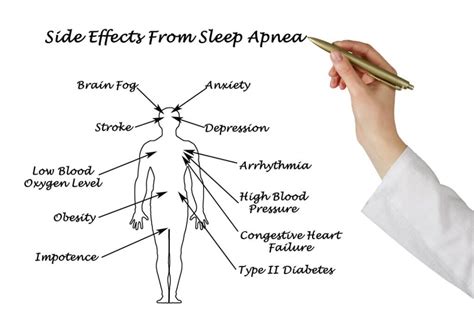 Va Benefits Verification Letter Sleep Apnea - Infoupdate.org