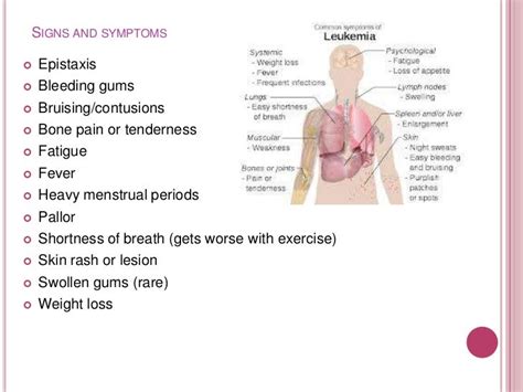 Aml symptoms in younger adults # pocugyko.web.fc2.com